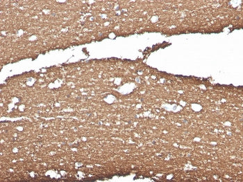IHC staining of FFPE human brain with Myelin Basic Protein antibody (clone MBP/4275). HIER: boil tis