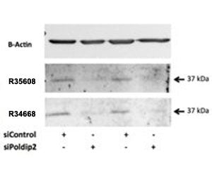 POLDIP2 Antibody