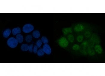 Immunofluorescent staining of FFPE human A431 cells with ATR antibody (green) and DAPI nuclear stain (blue). HIER: steam section in pH6 citrate buffer for 20 min.