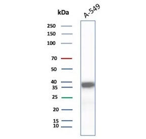 ARK1C1 Antibody / Aldo-keto Reductase Family 1 Member C1