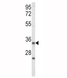 IGFBP2 Antibody