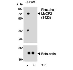 Phospho-MeCP2 Antibody (pS423)