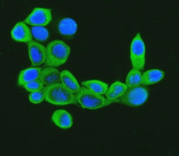 Immunofluorescent staining of FFPE human MCF7 cells with Cofilin antibody (green) and DAPI nuclear s