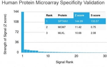 SPTAN1 Antibody / Alpha II Spectrin / Fodrin / NEAS