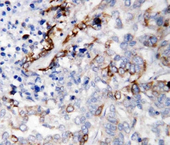 LAMC2 Antibody
