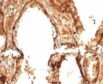 Recombinant HSP27 Antibody / HSPB1