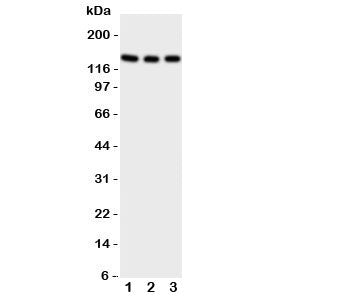 TrkC Antibody