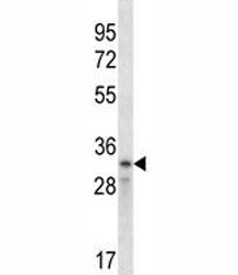 Cyclin D2 Antibody (CCND2)