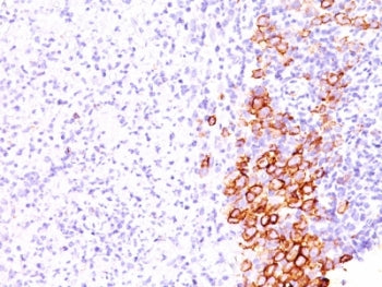CD30 Antibody