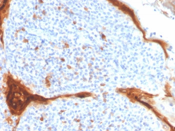 IL1RA Antibody / Interleukin-1 Receptor Antagonist / IL1RN