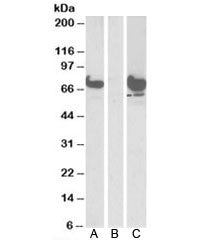 EPM2AIP1 Antibody