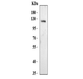 NLRP9 Antibody / NALP9