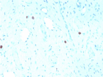 HPV-16 L1 Antibody