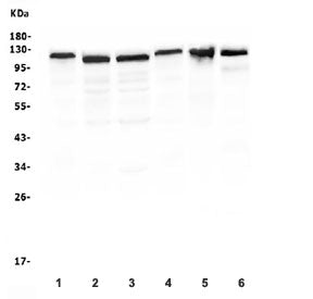Western blot testing of RIAM antibody and human 1) ThP-1, 2) Jurkat, 3) Raji, 4) U937, 5) rat thymus