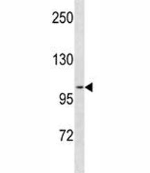 Progesterone Receptor Antibody