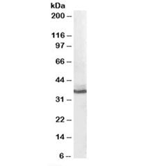 AKR1C4 Antibody