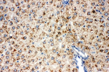 Lipoamide Dehydrogenase Antibody