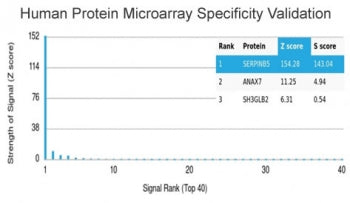 SERPINB5 Antibody / MASPIN