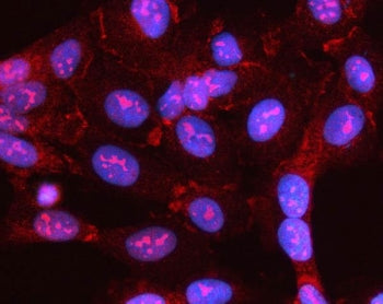 Immunofluorescent staining of FFPE human U-2 OS cells with MYL5 antibody (red) and DAPI nuclear stai