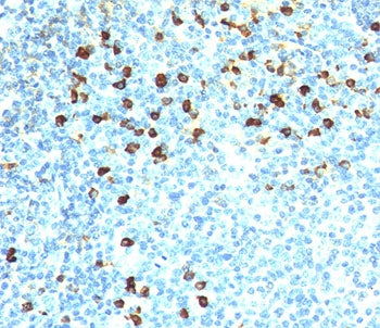IHC testing of human tonsil stained with Kappa antibody (clone KLC264). Note cell membrane & cytopla