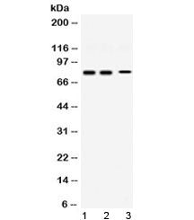 Western blot testing of 1) rat brain, 2) mouse brain and 3) human SHG-44 (human glioma) lysate with 