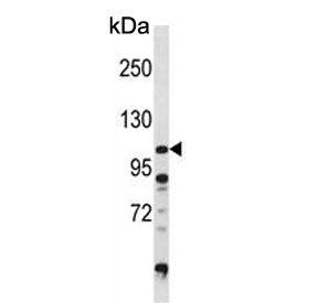 Diacylglycerol kinase zeta Antibody / DGKZ