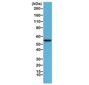 KRT8 Antibody / Cytokeratin 8