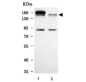 Western blot testing of human 1) HepG2 and 2) Jurkat cell lysate with TIMELESS antibody. Predicted m