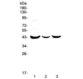 P2RY5 Antibody / P2Y Purinoceptor 5 / LPAR6