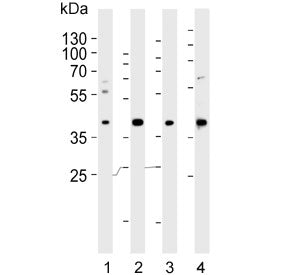 LOX-1 Antibody / OLR1