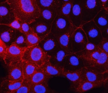 Immunofluorescent staining of FFPE human Caco-2 cells with PDGFR alpha antibody (red) and DAPI nucle