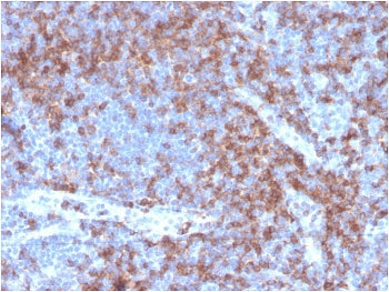 IHC staining of FFPE human tonsil with recombinant CD22 antibody (clone BLCAM/2637R). HIER: boil tis
