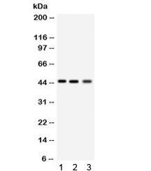 Western blot testing of 1) rat lung, 2) human RH35 and 3) HeLa lysate with RAGE antibody. Predicted 