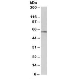 Western blot testing of human brain lysate with BAIAP2 antibody at 1ug/ml. Predicted molecular weigh