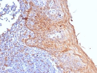 IHC staining of FFPE human tonsil tissue with STING1 antibody (clone STING1/7431). HIER: boil tissue
