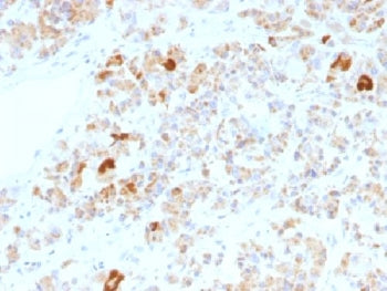 Luteinizing Hormone alpha Antibody / hCG alpha