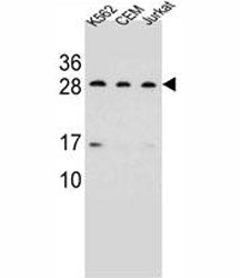 CD79a Antibody