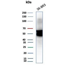 KRT7 Antibody / Cytokeratin 7