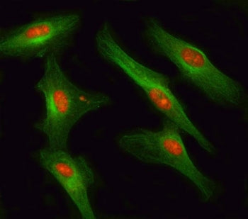 Immunofluorescent staining of FFPE human U-87 MG cells with RSBN1 antibody (red) and Beta Tubulin mA