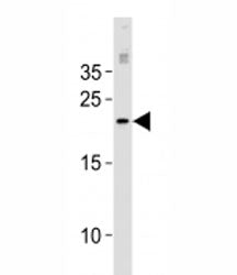 MGMT Antibody