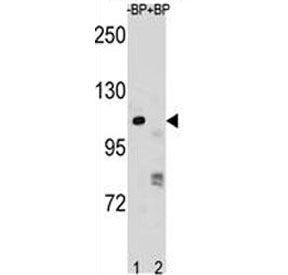 PARP1 Antibody