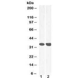 MDH2 Antibody / Malate dehydrogenase 2