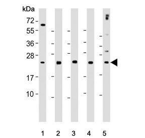 Western blot testing of human 1) WiDr, 2) Raji, 3) K562, 4) Jurkat and 5) CCRF-CEM cell lysate with 