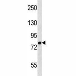 MMP9 Antibody