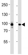 Western blot analysis of lysate from CEM, HeLa cell line (left to right) using STAT3 antibody at 1:1