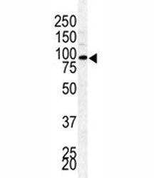 BAP1 Antibody