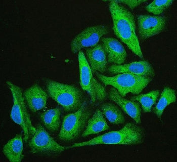 Cofilin 2 Antibody / CFL2