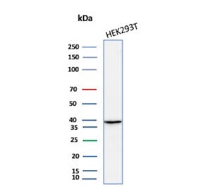 Western blot testing of human HEK293 cell lysate with AKR1B1 antibody (clone rAKR1B1/7295). Predicte