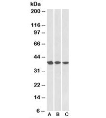 Western blot testing of A431 [A], HeLa [B] and MCF7 [C] nuclear lysates with APE1 antibody at 0.3ug/