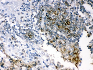 SHC Antibody